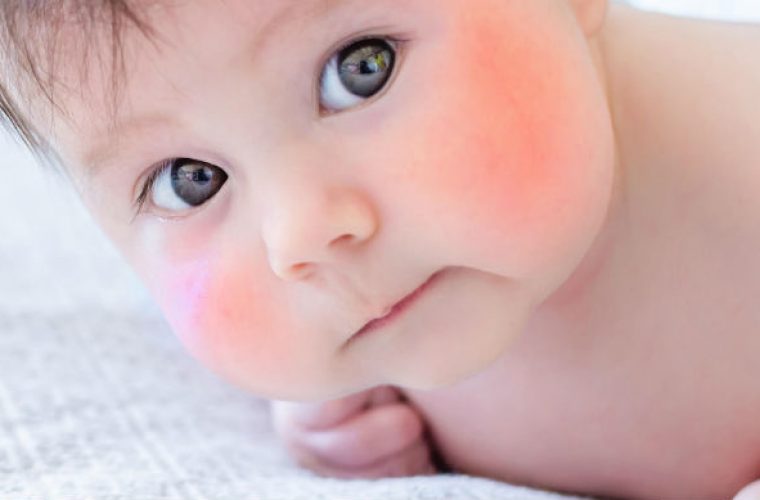 Ποιοι είναι οι λόγοι που ένα μωρό έχει κόκκινα μάγουλα;