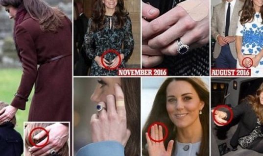 Γιατί η Κέιτ Μίντλετον έχει σχεδόν πάντα ένα τσιρότο στα δάχτυλά της;