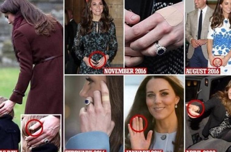 Γιατί η Κέιτ Μίντλετον έχει σχεδόν πάντα ένα τσιρότο στα δάχτυλά της;