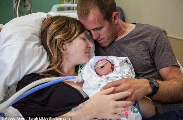 Μητέρα με τεράστια ψυχικά αποθέματα αποφάσισε να γεννήσει το ετοιμοθάνατο μωρό της για να το κρατήσει στην αγκαλιά της