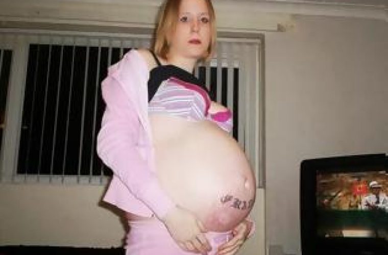 Κι όμως αυτή η γυναίκα δεν είναι έγκυος! Δείτε τι έχει