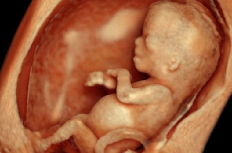 Φρικιαστικό: Βοσκός βρήκε δύο έμβρυα μέσα σε γυάλες δίπλα σε νεκροταφείο της Ημαθίας