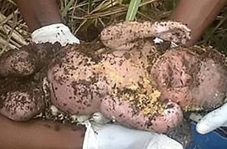 Φωτογραφία-σοκ: Εθαψε ζωντανό το μωρό της και οι συνάδελφοι της το έσωσαν τρεις μέρες μετά