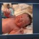 Viral φωτογραφία μωρού που γεννήθηκε με το αντισυλληπτικό σπιράλ στο χέρι- Όντως;