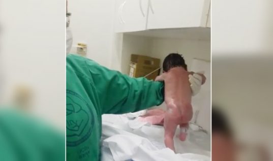 Απίστευτο βίντεο: Νεογέννητο περπατά λίγα μόλις λεπτά μετά τη γέννησή του!