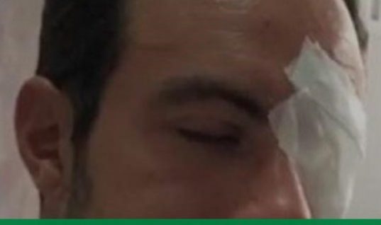 Survivor: Χτύπησε το μάτι σε αγώνα beach soccer ο Τανιμανίδης – Δείτε το περιστατικό (vid)