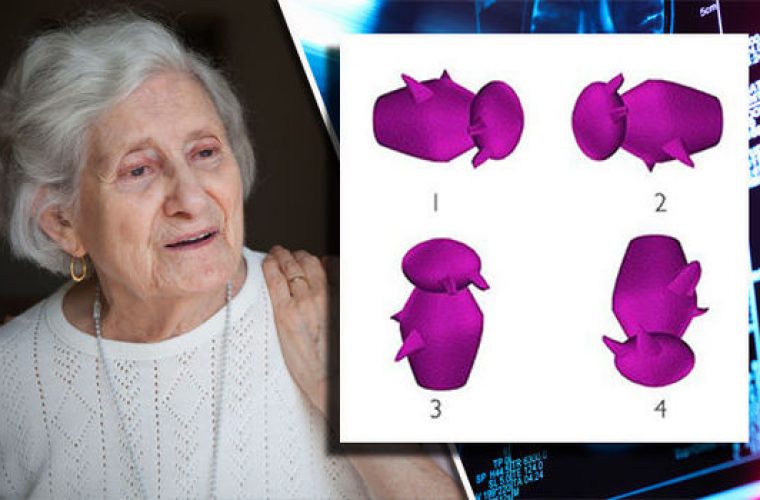 Ποιο σχήμα διαφέρει από τα άλλα; ΑΥΤΟ το τεστ «προβλέπει» το Αλτσχάιμερ λένε επιστήμονες! (εικόνες)