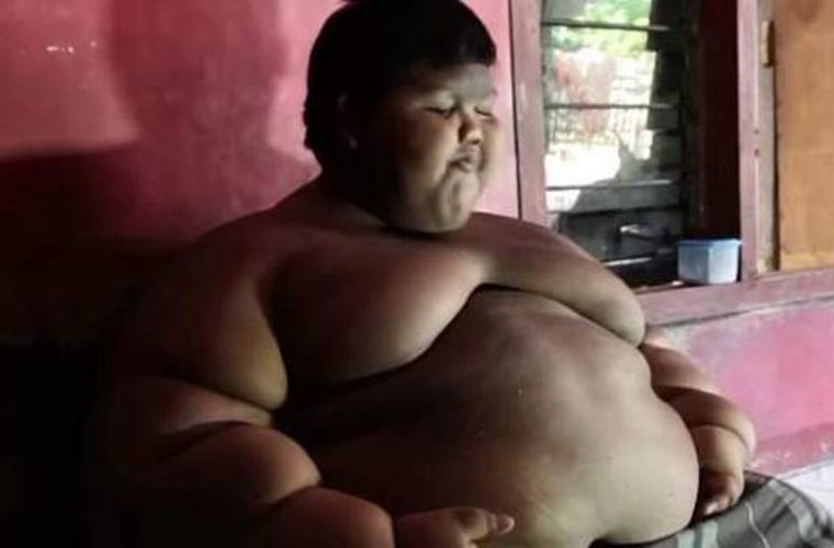 Το πιο χοντρό παιδί του κόσμου έχασε 76 κιλά – Δείτε το σήμερα (pics/vids)