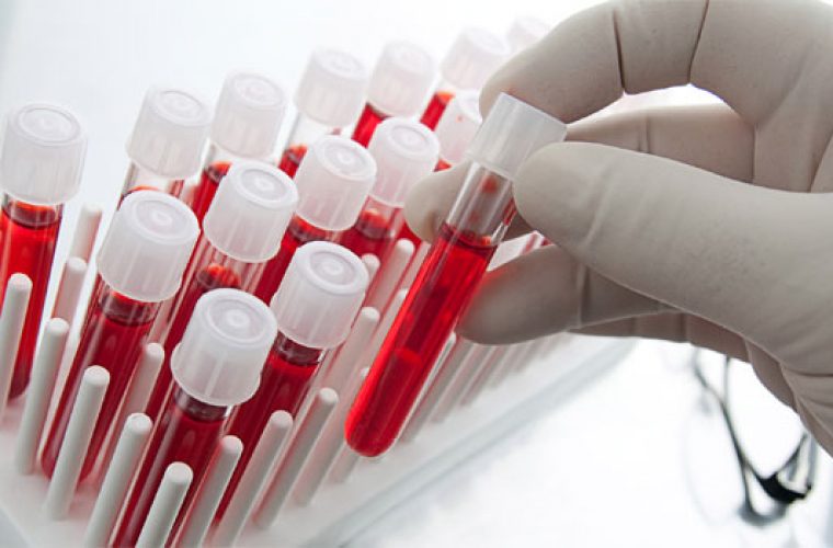 Τεστ αίματος θα ανιχνεύει οκτώ είδη καρκίνου