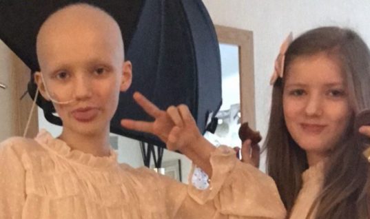Δίδυμη διαισθάνθηκε τον καρκίνο της αδελφής της και παρουσίασε όλα τα συμπτώματα