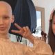 Δίδυμη διαισθάνθηκε τον καρκίνο της αδελφής της και παρουσίασε όλα τα συμπτώματα