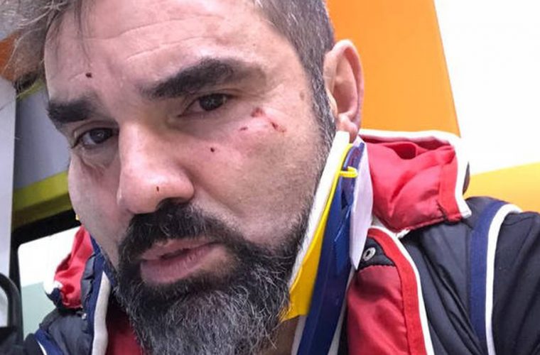 Θύμα επίθεσης έπεσε ο δημοσιογράφος Νάσος Γουμενίδης (vid)