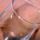 Μηνιγγίτιδα – Σημάδι στο δέρμα: Πώς γίνεται επιτόπου το «τεστ με το ποτήρι»(vid)