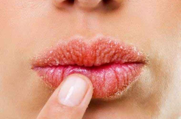 Η Ελιάνα Χρυσικοπούλου μας αποκάλυψε το πιο «τρελό» tip για τα σκασμένα χείλη!