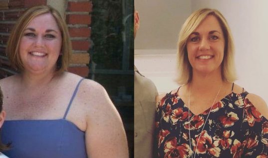 Αυτή η γυναίκα κατάφερε να χάσει 65 κιλά κόβοντας αυτές τις 3 τροφές!