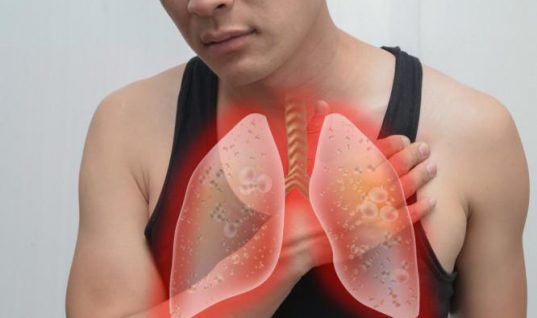 Καρκίνος του πνεύμονα και βήχας: Πώς συσχετίζονται