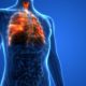 Μικροκυτταρικός καρκίνος του πνεύμονα: Τα συμπτώματα του πολύ επιθετικού καρκίνου
