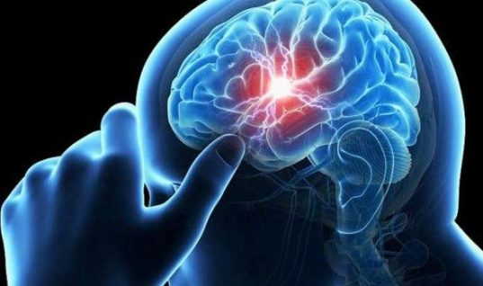 Ανεύρυσμα εγκεφάλου: Αυτά είναι τα πρώτα «αθώα» συμπτώματα