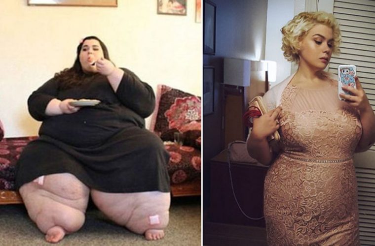 Η ιστορία της γυναίκας που ήταν 270 κιλά και έχασε 180 θα σας εμπνεύσει