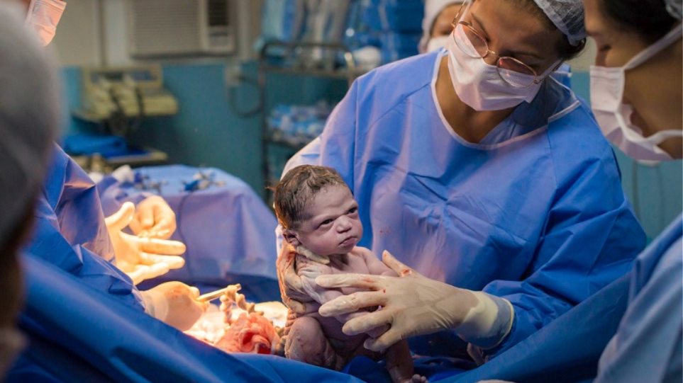 Θα κλάψετε από τα γέλια: Νεογέννητο κοιτά με νεύρα τον μαιευτήρα (εικόνα)