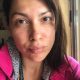 H Κλέλια Ρένεση με γρατσουνιές στο πρόσωπο: Το μήνυμα και η εξήγησή της