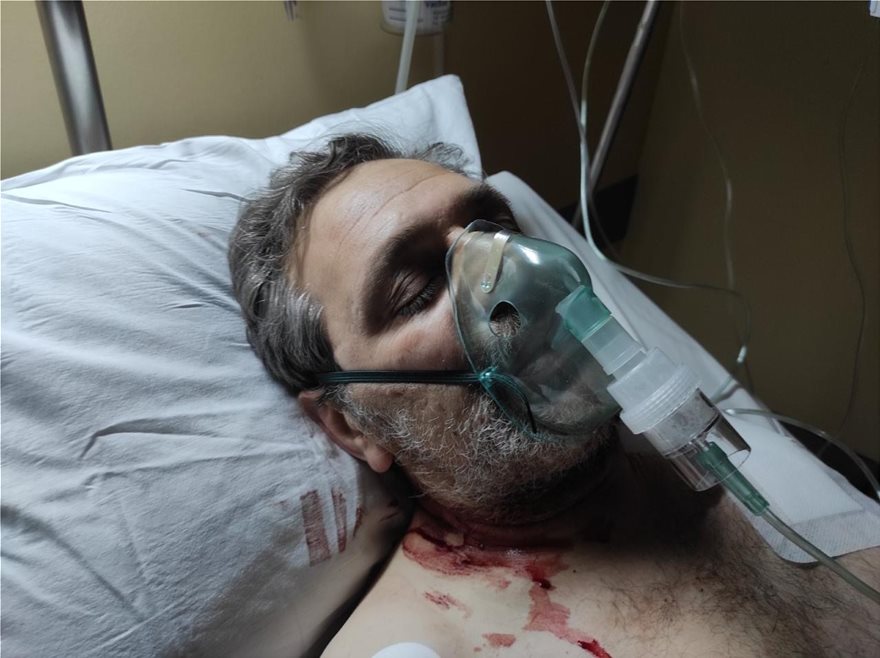Στέφανος Χίος: Νοσηλεύεται σε καταστολή μετά την δολοφονική επίθεση
