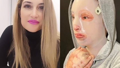 Η Ιωάννα Παλιοσπύρου δείχνει για πρώτη φορά το πρόσωπό της μετά την επίθεση με το βιτριόλι (σκληρές εικόνες)