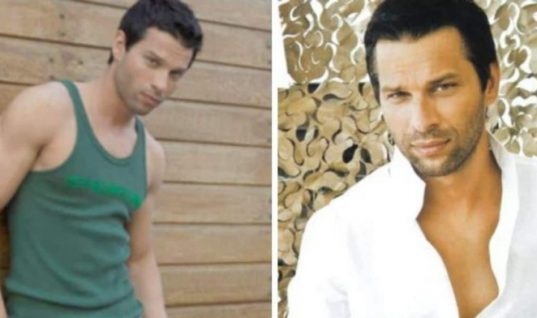 «Έκανα πλαστική στο πρόσωπο λόγω σοβαρού καρκίνου»: Άλλος άνθρωπος ο ηθοποιός Ασημάκης Αλεξίου! (εικόνες)